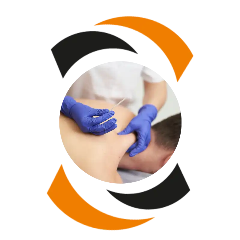 dry needling