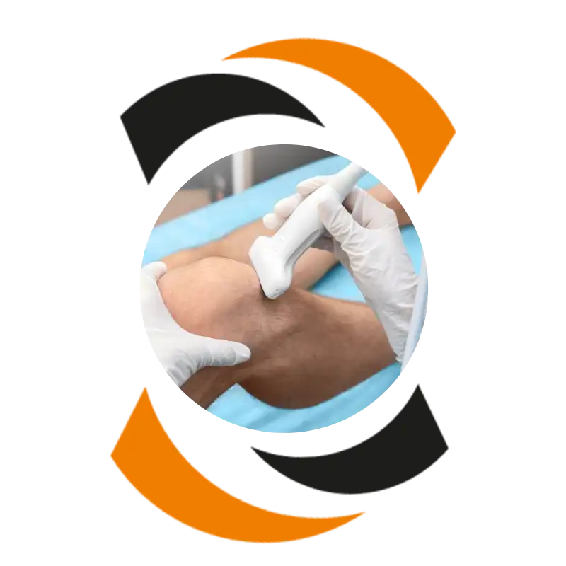 echografie b