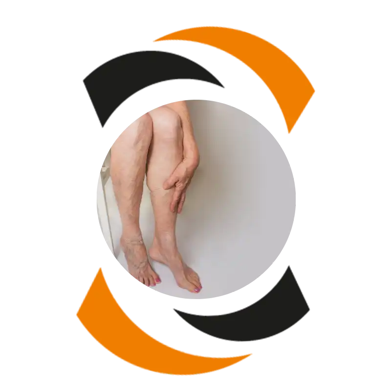 etalagebenen